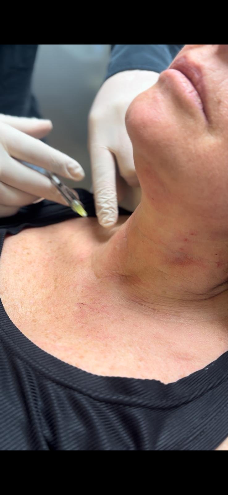 Kök Hücre Tedavileri