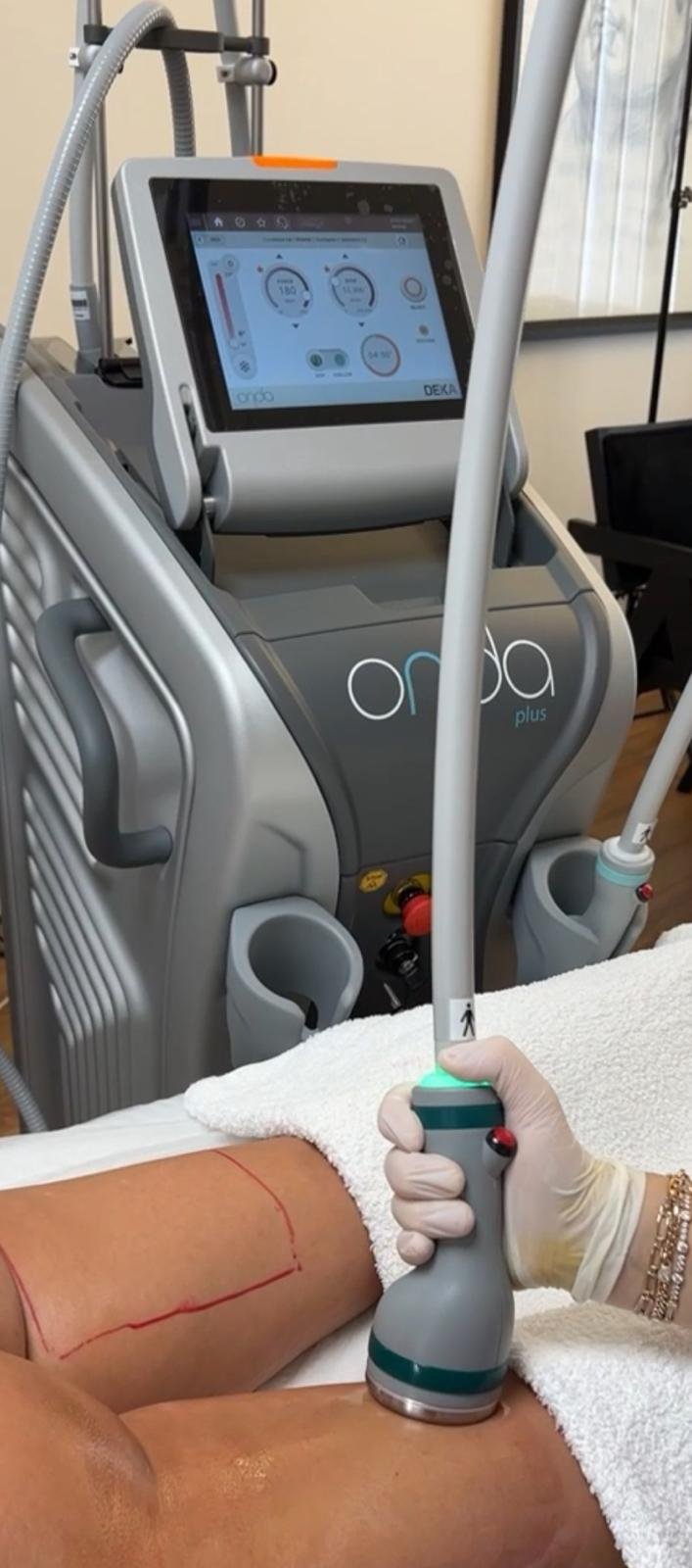 Onda Plus (bölgesel incelme – yüz & vücut)